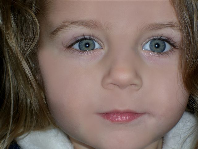 Addi big eyes