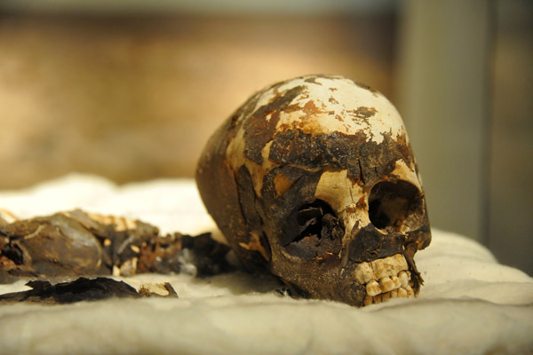 The Tashwinat Mummy - remains of a 5800 year old child discovered in 1958
