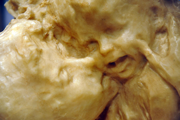 The Golden Age (Aetas Aurea), Medardo Rosso, 1884-1885