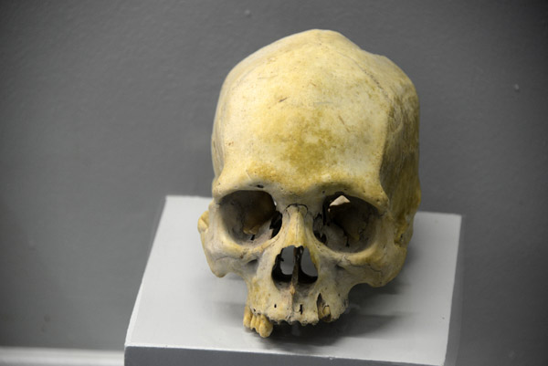 Ancient skull from a burial excavated in the Sigatoka sand dunes 