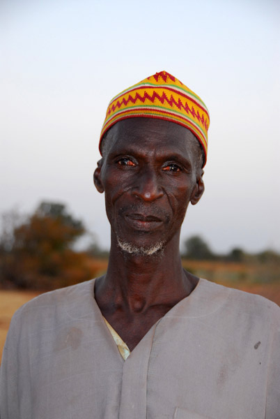 Man in Niger with some kind of eye disease
