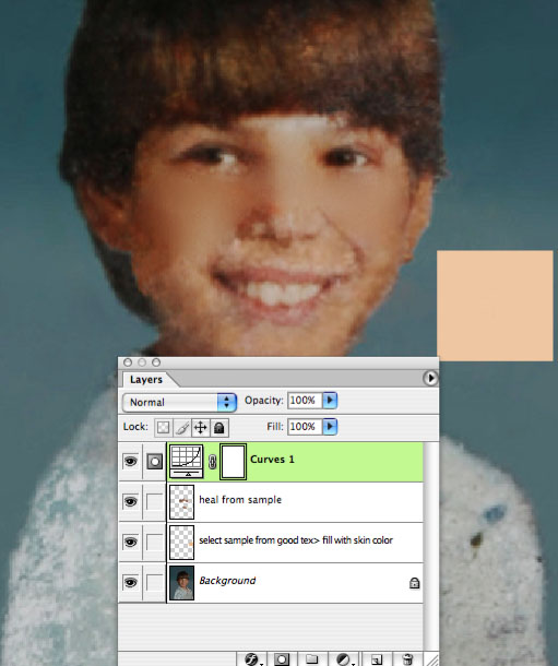 skin.jpg