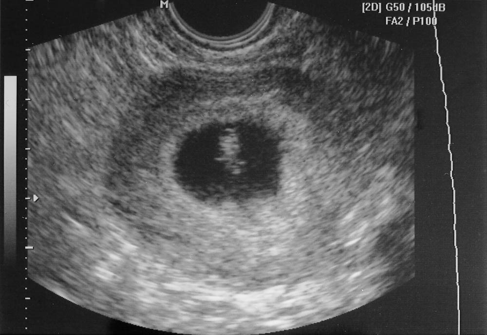 Ultrasound - Dec 1, 2009