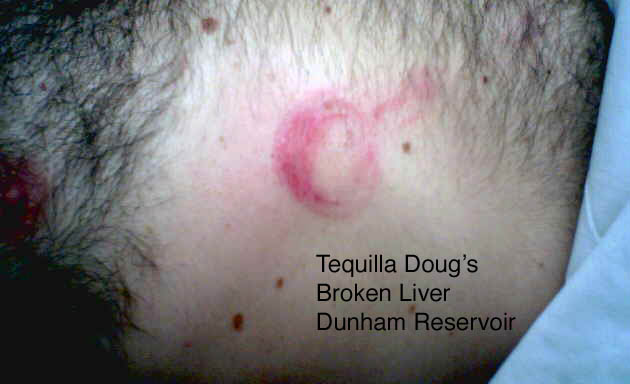 Tequillas liver ps.jpg