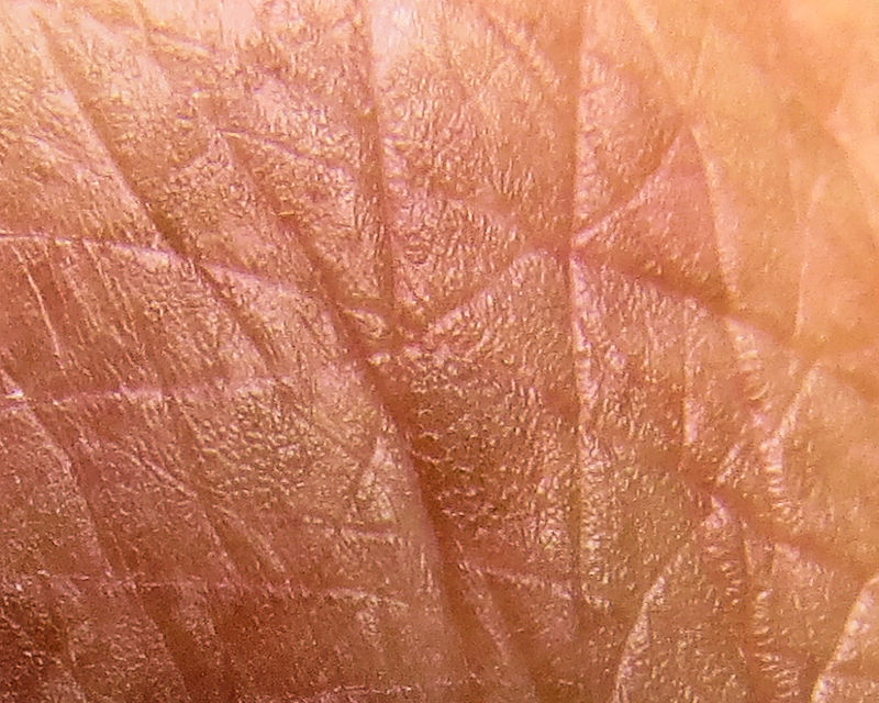 Skin but no mosquito - IMG_2258 