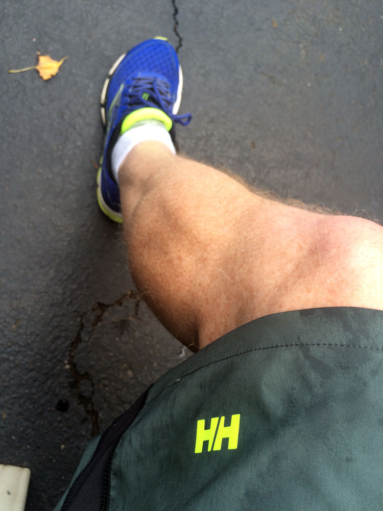 calfcramp.jpg