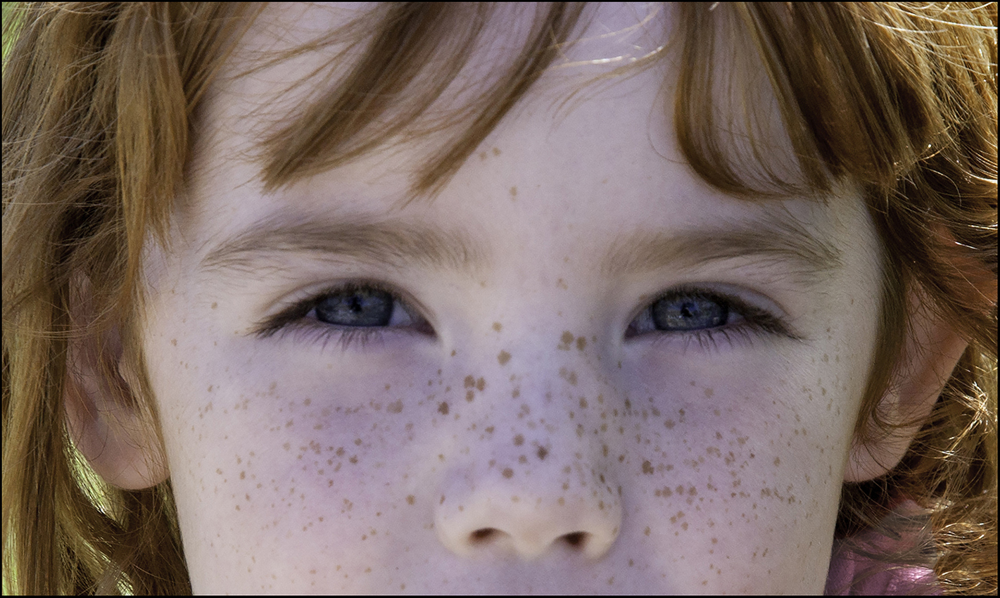 Pretty Freckles