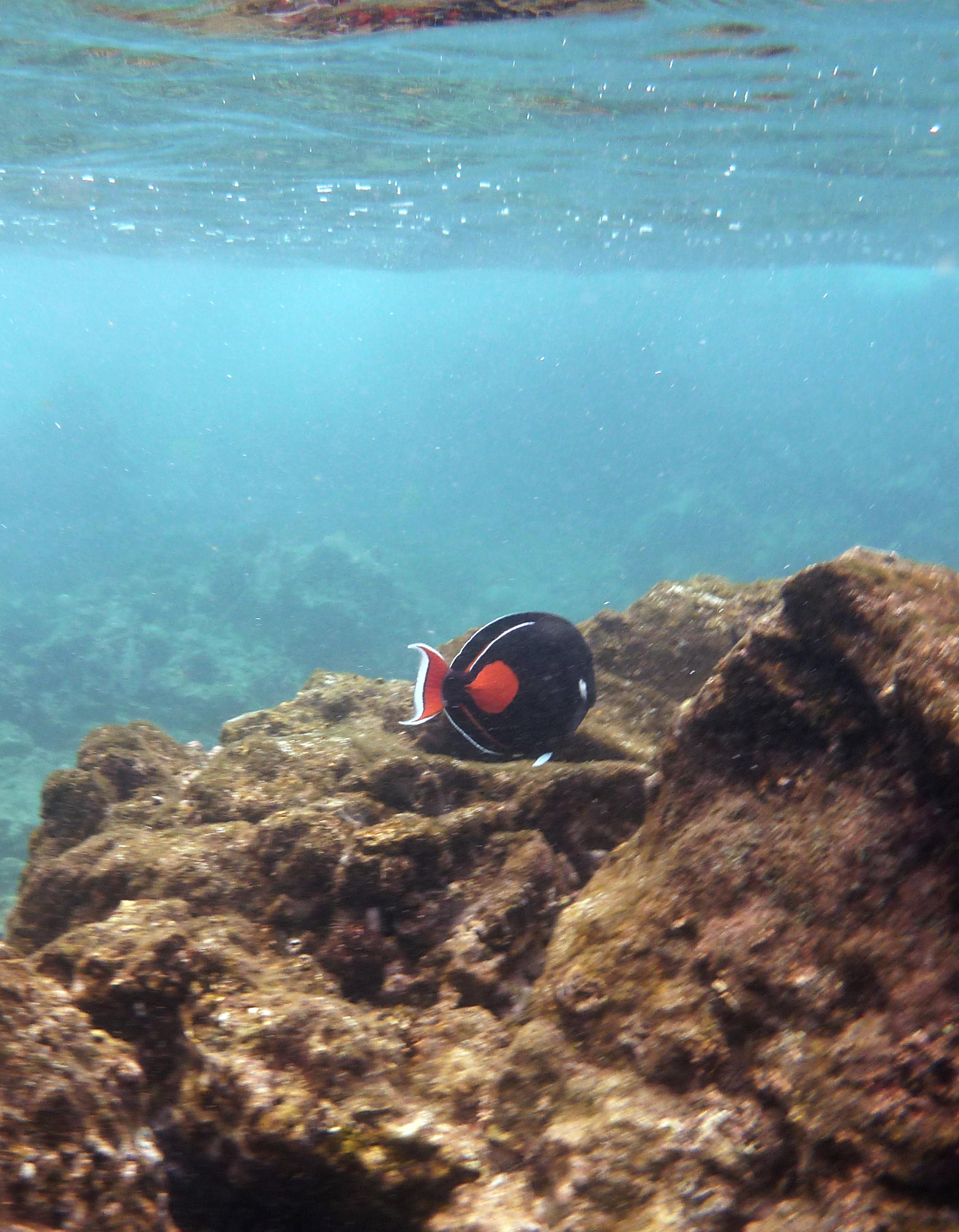 Achilles tang (I believe)