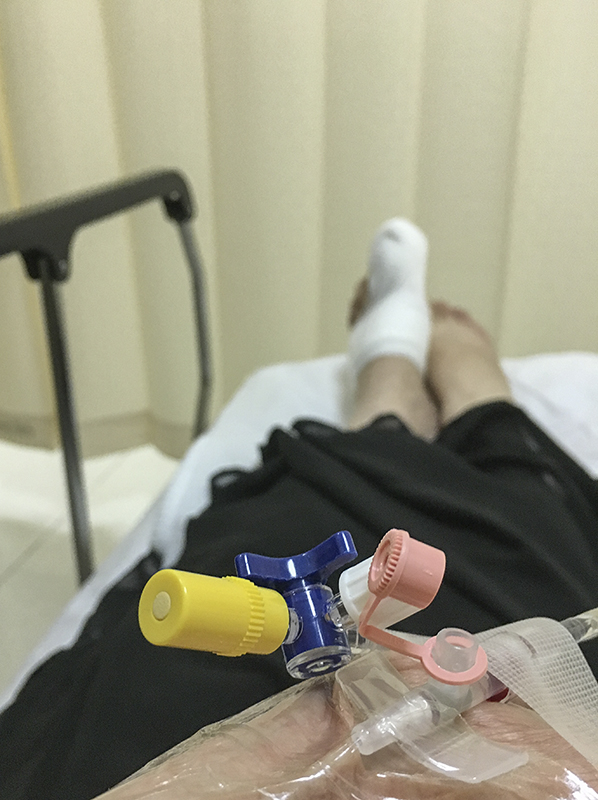 Falling turkeys and broken toes