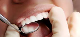 dental implants lexington ly