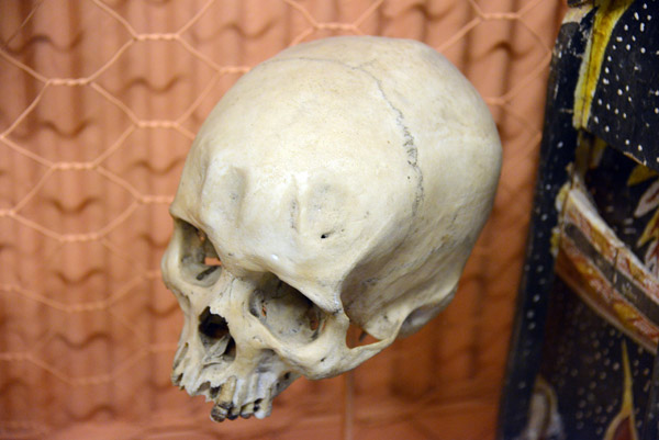 Skull showing grooves in forehead, incised in childhood, Lehir Island, New Ireland, PNG
