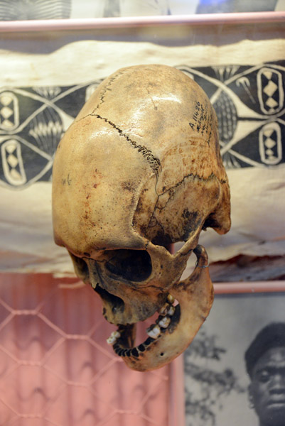 Distorted skull, Ablingi, West New Britain, PNG