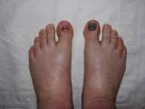toenails.jpg
