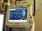 7/21/2010  Patient monitor