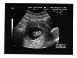 Hey guys.... thats me right there... my first sonogram....