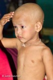 Where Is My Hair?