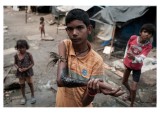 Boy using homemade remedy and peacock feather to heal a terrible wound on his arm, Mumbai