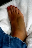 After the bus.  Yeah.  Its broken.  Swelling is gone from the toes and is receding but has a ways to go yet.