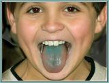 November 30 - Blue Tongue