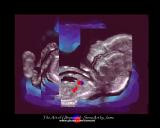 20 Wks.Old  picaso