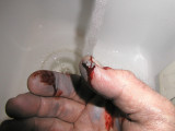 Ouch - thumb in the chuck!