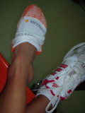 bummer!  bad ankle sprain