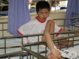 Mổ Ci Thị Ngh-Center For Handicapped Children