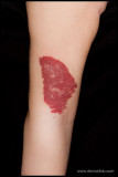 HAEMANGIOMA_HEMANGIOMA_04.JPG