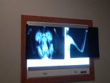 X-rays show no broken bones, just a terrible headache.
