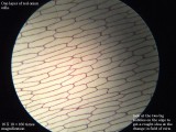 Onion Cells medium power explained