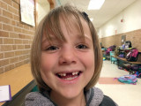 Just a few days later - another tooth down!