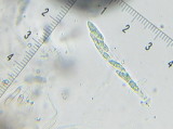 Echinosphaeria canescens 003 ascus 14-5-2016.JPG