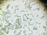 Inocybe kuthanii 004 spores.JPG