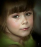 Cornelia de Lange Syndrome (CdLS)