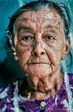 Estanza Gomez, Age 64, Cataracts
