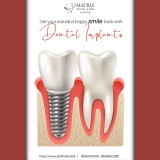 Dental implant in Delhi