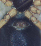 Linyphiidae Epigyne