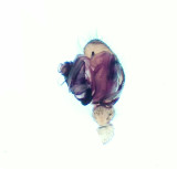 Linyphia triangularis ( ngsbaldakinspindel )