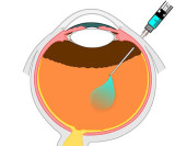 Eye Surgeon in Houston | Shaikhmd.com