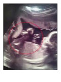 Angel in Ultrasound sign 18 x 24.jpg