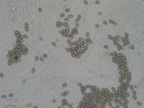 Geelbruine spleetvezelkop  sporen 4 X 3  m - Inocybe rimosa