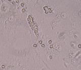 Sporen Clitopilus mundula