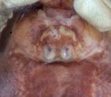 Risarp Halland 14.6-22 epigyne adult female