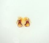 Nackhlle Halland 30.3-24 vulva adult female