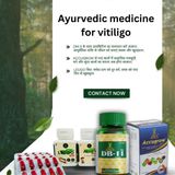 Ayurvedic medicine for vitiligo - 1