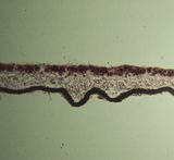 Foliose Lichen section