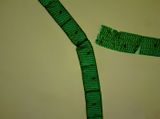 Spirogyra algae  -with spiral chloroplasts-