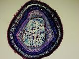 Xylophyta Dicot  -stem of a legume-