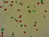 microscopic Pond algae  -Chiamy domonas-