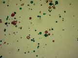 Protococcus  -colonies of a type of green Algae-